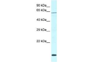 WB Suggested Anti-Dcaf11 Antibody   Titration: 1. (DCAF11 anticorps  (C-Term))