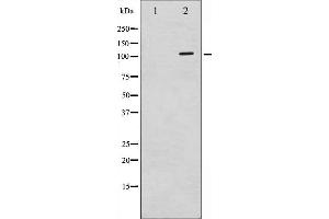 Western blot analysis of c-PLA2 phosphorylation expression in TNF-a treated HeLa whole cell lysates,The lane on the left is treated with the antigen-specific peptide. (PLA2G4A anticorps  (pSer505))