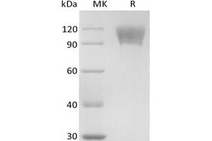 Western Blotting (WB) image for Tumor Necrosis Factor Receptor Superfamily, Member 8 (TNFRSF8) protein (mFc Tag) (ABIN7319925)