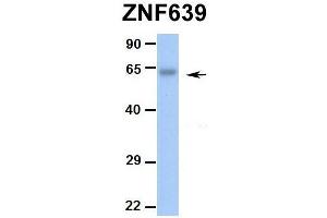 Hum. (ZNF639 anticorps  (N-Term))