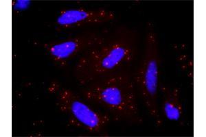 Proximity Ligation Analysis of protein-protein interactions between AKT1 and PPM1A.