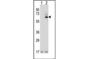 Western blot analysis of FASTK (arrow) using FAST kinase (C-term) Antibody (C-term) Cat. (FASTK anticorps  (C-Term))