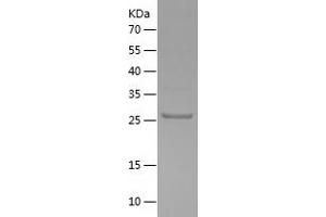 Western Blotting (WB) image for Fibroblast Growth Factor 3 (FGF3) (AA 13-239) protein (His tag) (ABIN7122940)