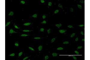 Immunofluorescence of monoclonal antibody to HMGXB4 on HeLa cell. (HMGXB4 anticorps  (AA 1-74))