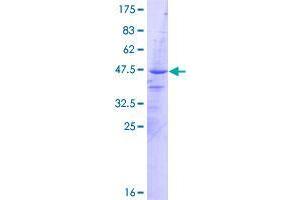 Image no. 1 for Arginine Vasopressin Induced Protein 1 (AVPI1) (AA 1-147) protein (GST tag) (ABIN1346232)