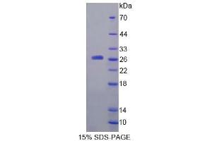 SDS-PAGE analysis of Rat a4GALT Protein. (A4GALT Protéine)