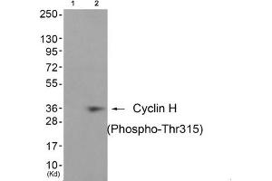 Western blot analysis of extracts from JK cells (Lane 2), using Cyclin H (Phospho-Thr315) Antibody. (Cyclin H anticorps  (pThr315))