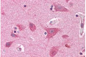 Human Brain, Cortex: Formalin-Fixed, Paraffin-Embedded (FFPE)