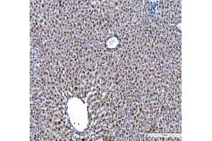 IHC analysis of hnRNP L/HNRNPL using anti-hnRNP L/HNRNPL antibody (ABIN7600130). (HNRNPL anticorps  (AA 152-569))