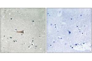 Immunohistochemistry analysis of paraffin-embedded human brain, using DDR1 (Phospho-Tyr513) Antibody.