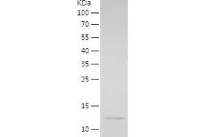 Western Blotting (WB) image for Ecotropic Viral Integration Site 2A (EVI2A) (AA 155-236) protein (His tag) (ABIN7122735)