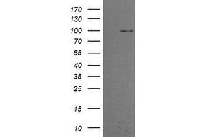 Image no. 2 for anti-Phosphoinositide-3-Kinase, Regulatory Subunit 5 (PIK3R5) antibody (ABIN1500216)