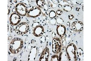 Immunohistochemical staining of paraffin-embedded Kidney tissue using anti-PLEKmouse monoclonal antibody. (Pleckstrin anticorps)
