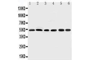 Anti-Smad2 antibody, Western blotting Lane 1: Rat Brain Tissue Lysate Lane 2: HELA Cell Lysate Lane 3: SMMC Cell Lysate Lane 4: JURKAT Cell Lysate Lane 5: U87 Cell Lysate Lane 6: MCF-7 Cell Lysate (SMAD2 anticorps  (N-Term))