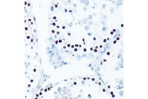 Immunohistochemistry of paraffin-embedded rat testis using Phospho-Histone H2AX-S139 antibody (ABIN6135258, ABIN6136140, ABIN6136141 and ABIN7101881) at dilution of 1:100 (40x lens).