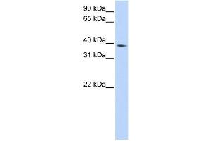 WB Suggested Anti-NCF4 Antibody Titration:  0. (NCF4 anticorps  (Middle Region))