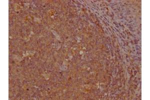 IHC image of ABIN7154410 diluted at 1:200 and staining in paraffin-embedded human tonsil tissue performed on a Leica BondTM system. (GNLY anticorps  (AA 23-145))