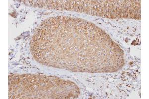 IHC-P Image Immunohistochemical analysis of paraffin-embedded human normal oral, using PTGFRN, antibody at 1:100 dilution.