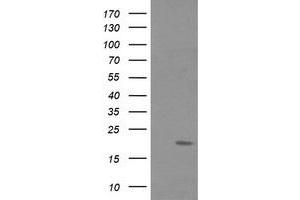 Image no. 2 for anti-Fetal and Adult Testis Expressed 1 (FATE1) antibody (ABIN1498224) (FATE1 anticorps)