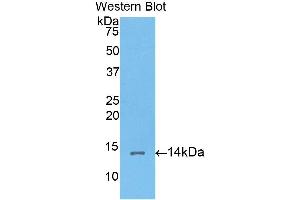 Western Blotting (WB) image for anti-Corin, Serine Peptidase (CORIN) (AA 533-634) antibody (ABIN1176522)