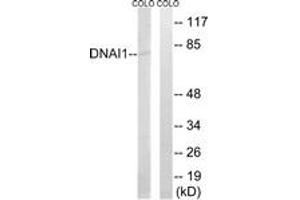 Western blot analysis of extracts from COLO cells, using DNAI1 Antibody. (DNAI1 anticorps  (AA 211-260))