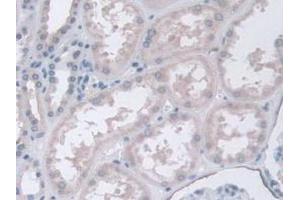 IHC-P analysis of Human Kidney Tissue, with DAB staining. (CPA4 anticorps  (AA 55-421))