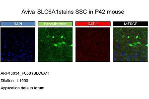 Image no. 2 for anti-GABA Transporter 1 (GAT1) (Middle Region) antibody (ABIN2781581)