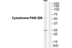 Western blot analysis of extracts from K562 cells, using CYP2D6 antibody.