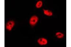 ABIN6267293 staining MDA-MB-435 by IF/ICC.
