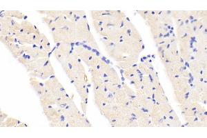 Detection of BACE2 in Mouse Cardiac Muscle Tissue using Polyclonal Antibody to Beta Secretase 2 (BACE2) (BACE2 anticorps  (AA 156-407))