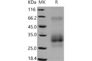 Western Blotting (WB) image for TNF Receptor Superfamily, Member 6 (FAS) (Active) protein (His tag) (ABIN7321232)
