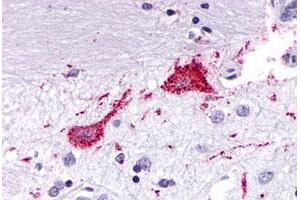Immunohistochemical (Formalin/PFA-fixed paraffin-embedded sections) staining in human brain, neurons and glia with KISS1R polyclonal antibody . (KISS1R anticorps  (3rd Cytoplasmic Domain))