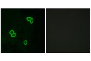 Immunofluorescence analysis of LOVO cells, using LPHN1 antibody. (Latrophilin 1 anticorps  (Internal Region))