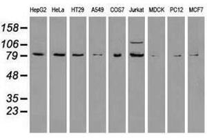 Image no. 6 for anti-B-Raf proto-oncogene, serine/threonine kinase (BRAF) antibody (ABIN1496954) (BRAF anticorps)