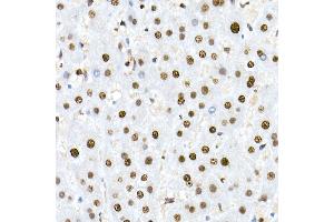Immunohistochemistry of paraffin-embedded human liver using Nucleolin Rabbit mAb (ABIN7269035) at dilution of 1:25 (40x lens). (Nucleolin anticorps)