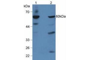 Figure. (GBA anticorps  (AA 334-498))
