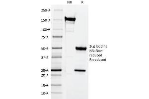 SDS-PAGE Analysis Purified CD3e Mouse Monoclonal Antibody (CRIS-7).