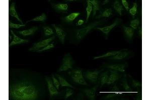 Immunofluorescence of monoclonal antibody to GFRA1 on HeLa cell. (GFRA1 anticorps  (AA 32-119))