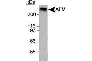 Western blot analysis of ATM in HeLa whole cell lysate using ATM polyclonal antibody . (ATM anticorps  (C-Term))