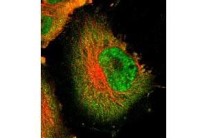 Immunofluorescent staining of U-251 MG with USP5 polyclonal antibody  (Green) shows positivity in cytoplasm and nucleus but excluded from the nucleoli. (USP5 anticorps)