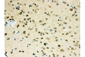 Anti- VCP Picoband antibody, IHC(P) IHC(P): Mouse Brain Tissue