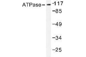 Western blot (WB) analysis of Na+/K+ ATPase alpha-1 antibody in extracts from 293 PMA 125ng/ml 30' cells. (ATP1A1 anticorps)