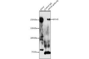 Immunoprecipitation analysis of 300 μg extracts of HeLa cells using 3 μg MYH9 antibody (ABIN1513234, ABIN3020656, ABIN3020657 and ABIN6213646). (Myosin 9 anticorps  (AA 1711-1960))