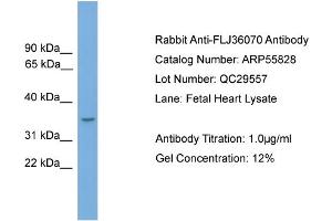 WB Suggested Anti-FLJ36070  Antibody Titration: 0. (FLJ36070 (N-Term) anticorps)
