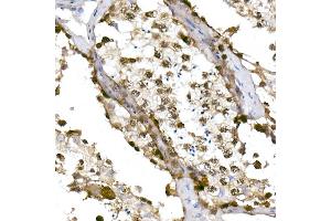 Immunohistochemistry of paraffin-embedded human testis using TET1 Rabbit mAb (ABIN7270777) at dilution of 1:100 (40x lens). (TET1 anticorps)