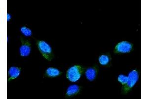 IF analysis of GRK2 using anti-GRK2 antibody (ABIN5693069).