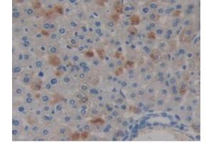 IHC-P analysis of Mouse Liver Tissue, with DAB staining. (COMP anticorps  (AA 554-753))