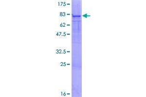 Image no. 1 for 6-phosphofructo-2-Kinase/fructose-2,6-Biphosphatase 4 (PFKFB4) (AA 1-469) protein (GST tag) (ABIN1314742)