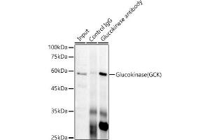 Immunoprecipitation analysis of 300 μg extracts of HeLa cells using 3 μg Glucokinase (GCK) antibody (ABIN7267396).