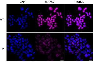 Immunocytochemical staining of Hela cells using RAD23A antibody (ABIN7800116), 1:1,000), Top panel: wild-type (WT), Bottom panal: RAD23A shRNA knockdown (KD). (Recombinant RAD23A anticorps)